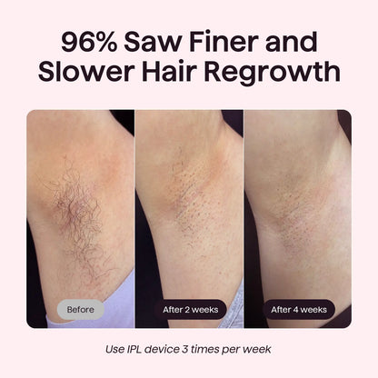 JJJSHOP Bare It IPL Hair Removal with Ice Cooling, 3 Modes & 24J Dual-Pulse for Salon-Level Results on Face, Body & Bikini, Painless & Precise